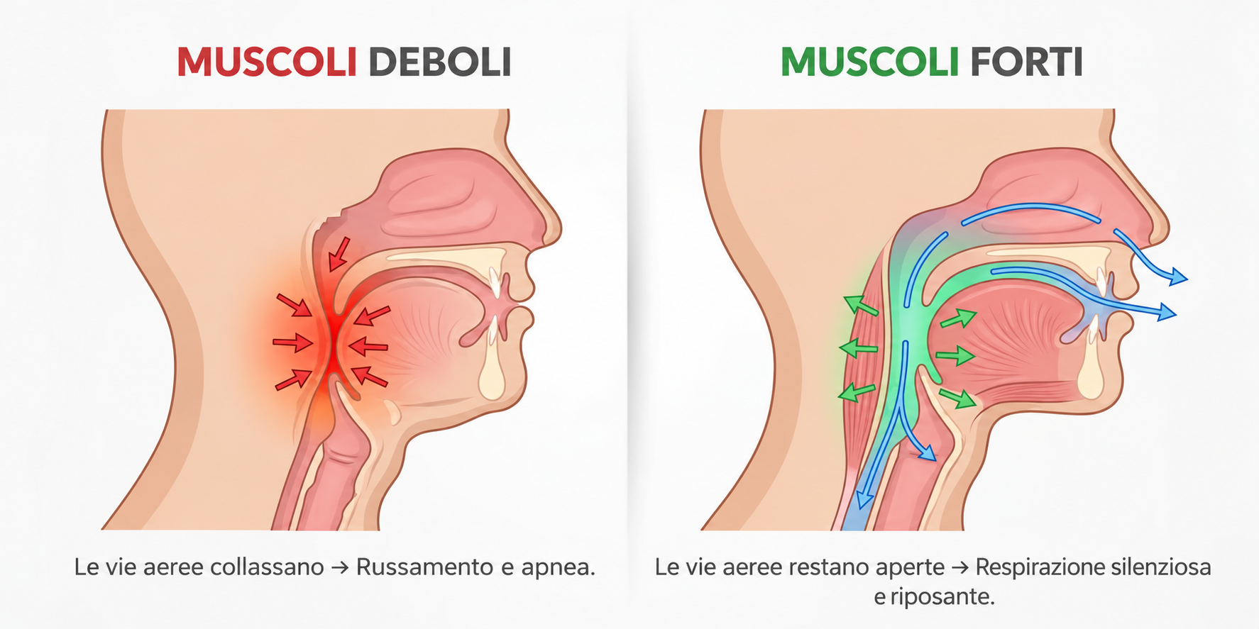 Vie aeree ristrette e aperte