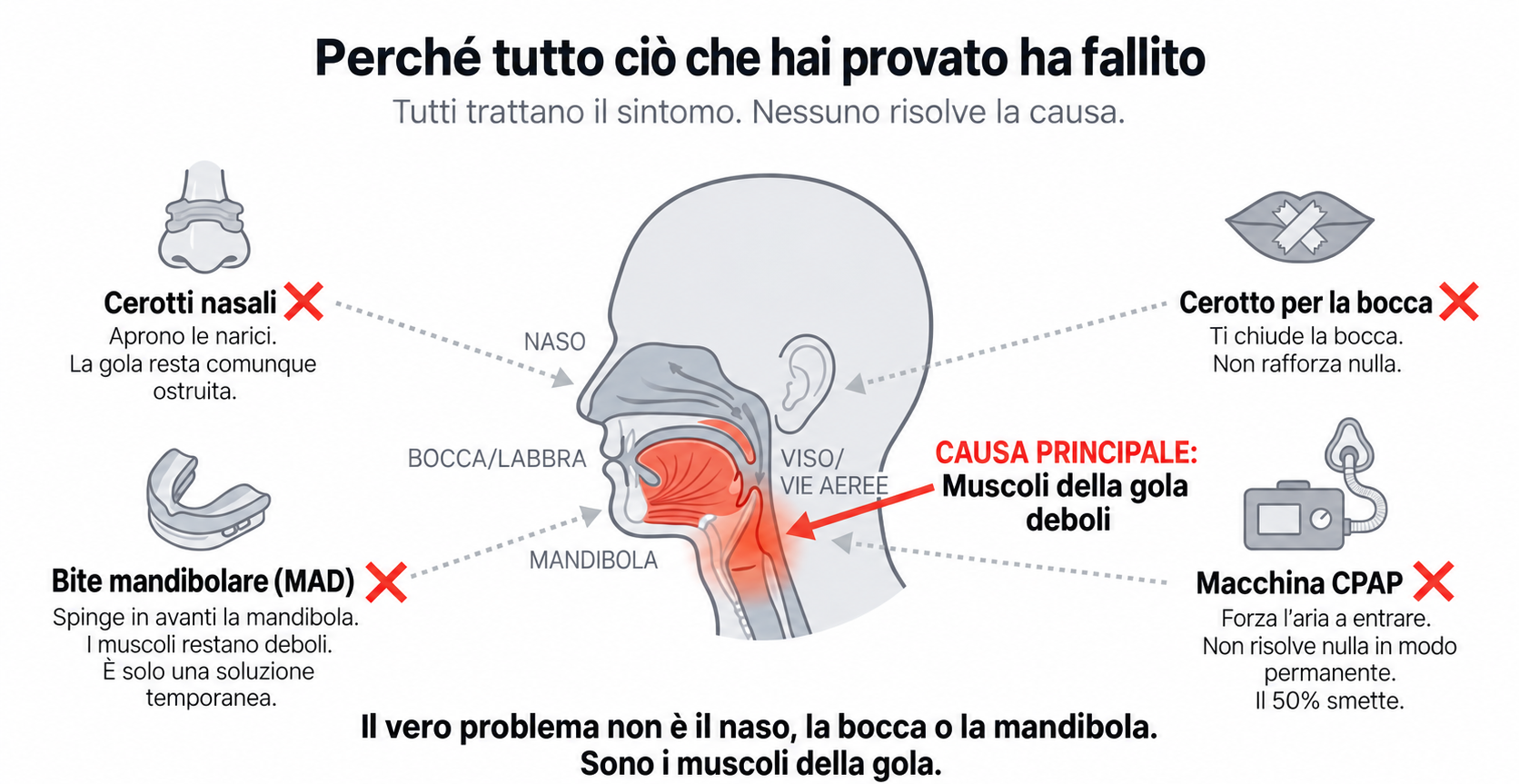 Perché cerotti, CPAP e bite non funzionano